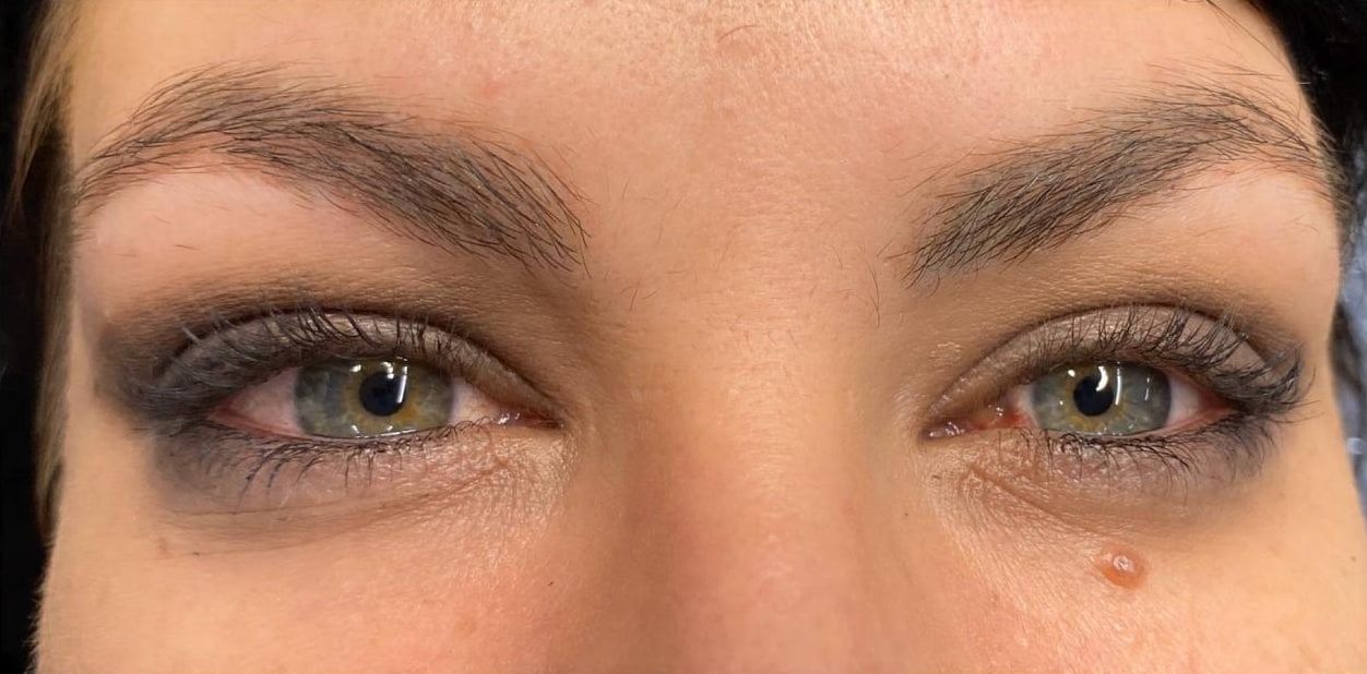 Both eyes before permanent makeup: thin, sparse brows that fade out at the tails.